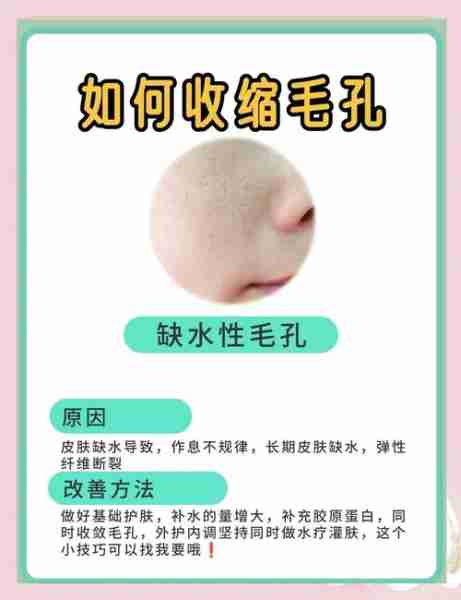 毛孔粗大日常收缩护理妙招/毛孔粗大 收缩毛孔用什么护肤品好